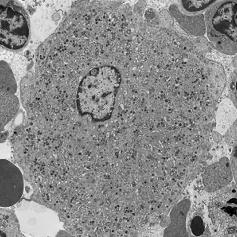 Transmission electron microscopy of a mouse bone marrow megakaryocyte.